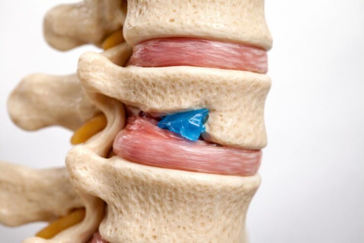 découvrez des témoignages d'experts sur les conséquences d'un morceau de plastique coincé dans la colonne commune et son impact environnemental et sanitaire.